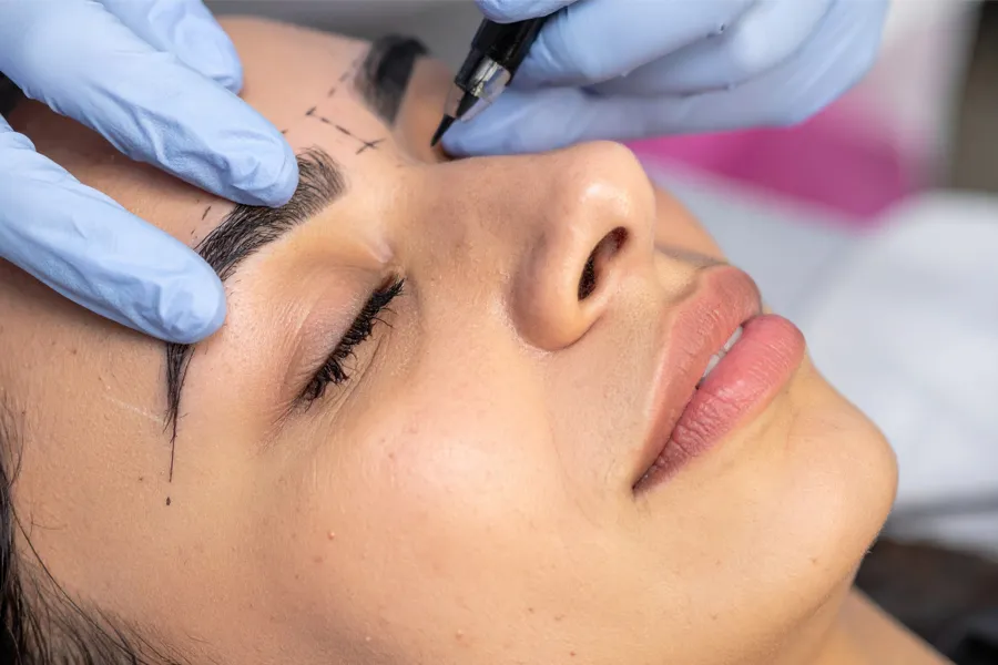 A clinician draws dashes on a woman's brow, preparing for a brow lift treatment. Get a brow lift from Dr. Hadi Michael Rassael at Millennium Wellness in Bethesda-Chevy Chase.