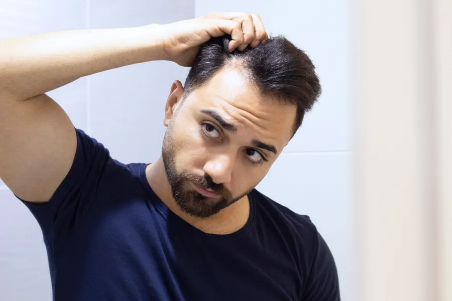 A man in a navy t-shirt looks in the mirror worrying about and touching his receding hairline, considering PRP for hair loss and restoration treatment from Dr. Hadi Michael Rassael at Millennium Wellness in Bethesda-Chevy Chase.